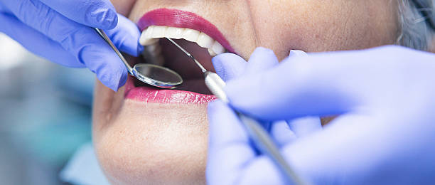 Best Urgent Dental Care  in Redwood City, CA